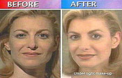 30 Second Facelift